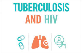 hiv tb